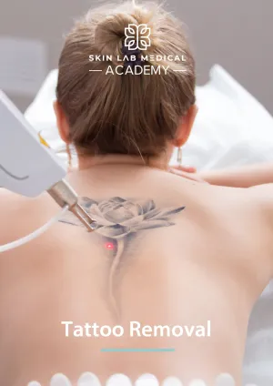 IPL Laser Tattoo Removal Manual